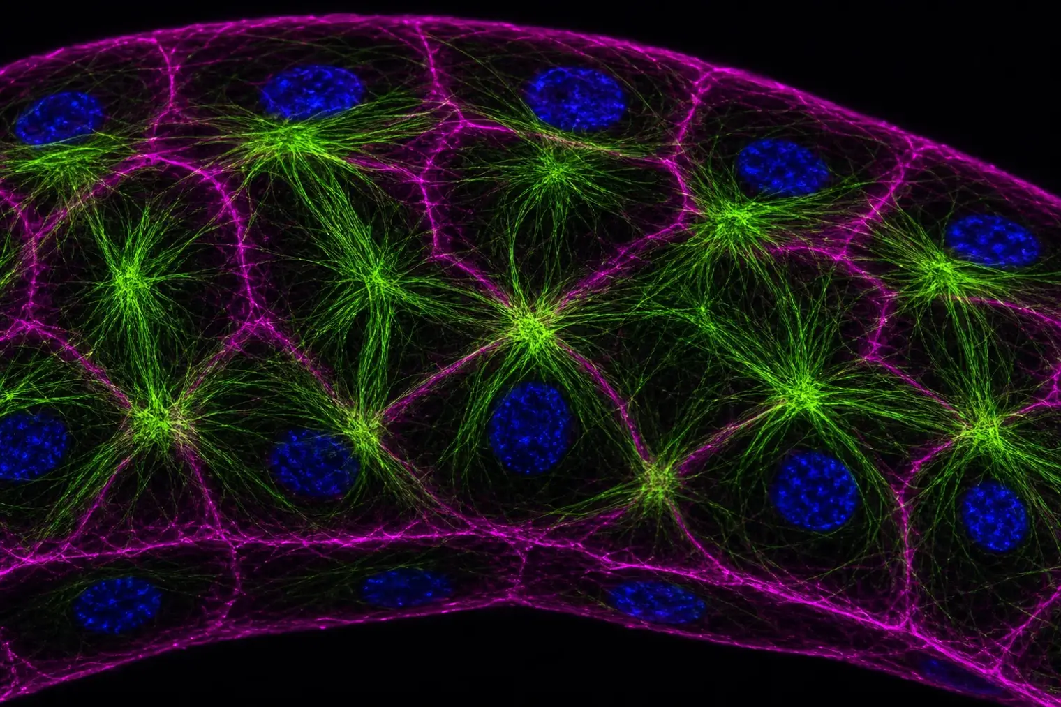 Confocal microscopy-style view of a stretched epithelial cell sheet showing green keratin bundles, magenta actin at cell edges and blue nuclei.