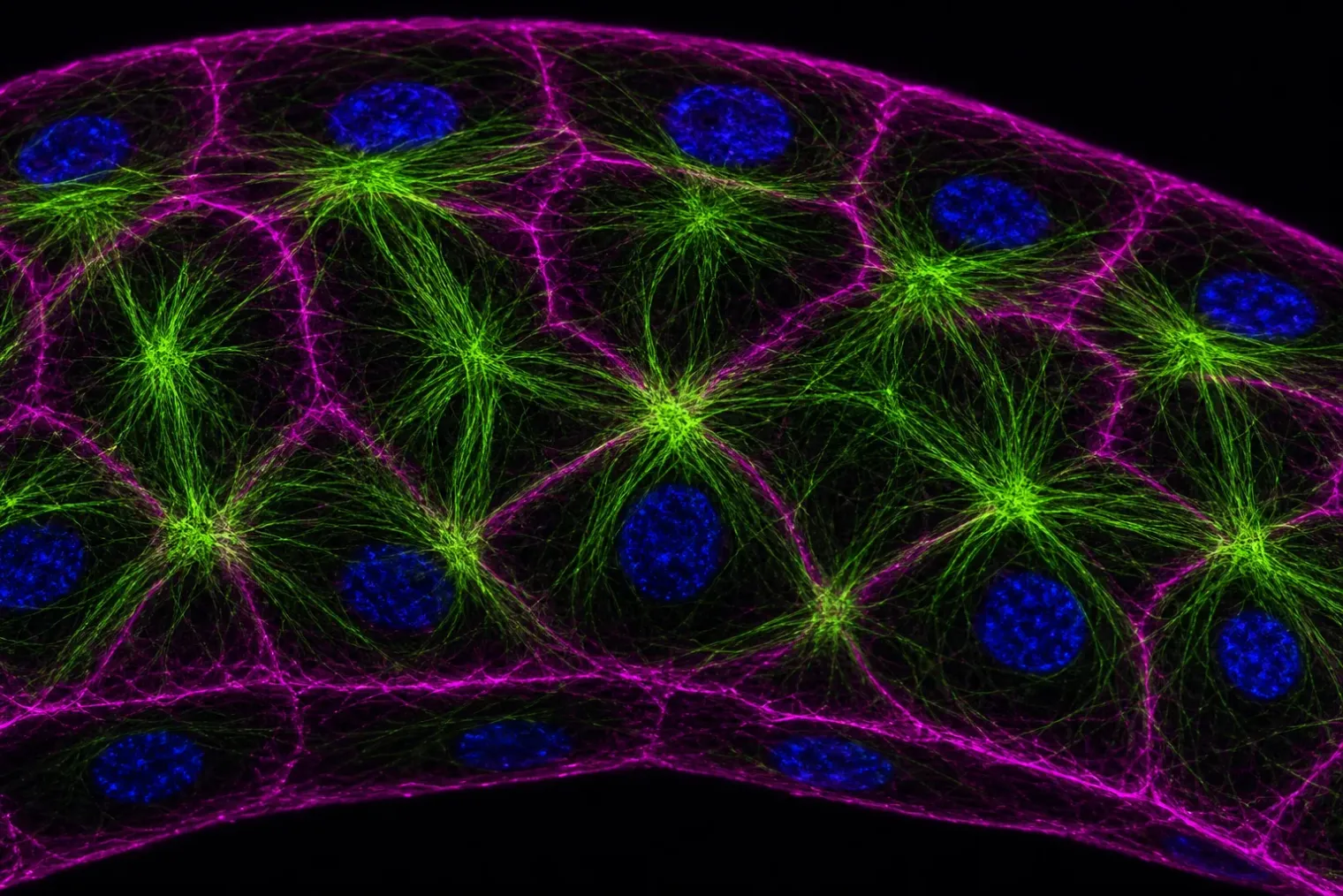 Confocal microscopy-style view of a stretched epithelial cell sheet showing green keratin bundles, magenta actin at cell edges and blue nuclei.